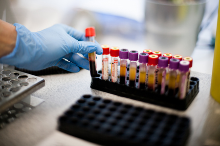 Diagnosis of coronavirus infection